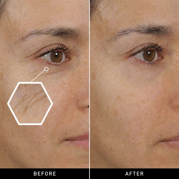 Botox Bee Venom Wrinkle Cream – Anti-Aging & Collagen Boosting Moisturizer for Firm, Tight, and Hydrated Skin - alternate view