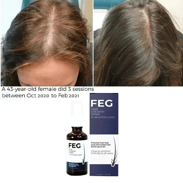 FEG Hair Growth Spray – Natural Anti-Hair Loss & Follicle Stimulating Treatment for Thicker, Fuller Hair (50ml) - alternate view