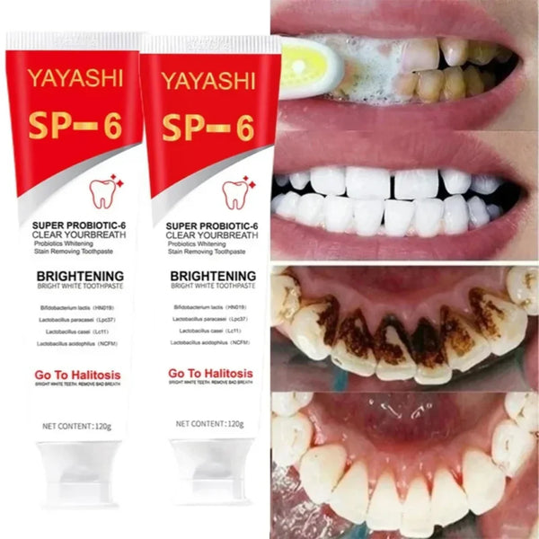YAYASHI SP-6 Ultra Whitening Toothpaste – Super Probiotic Formula for Stain Removal, Fresh Breath & Bright White Teeth (120g) - alternate view