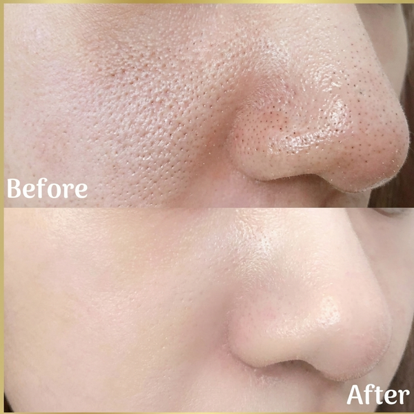 Celimax Vita A Retinal Shot Anti-Aging Serum – 0.1% Retinal & 3% Matrixyl | Wrinkle & Pore Minimizer - alternate view